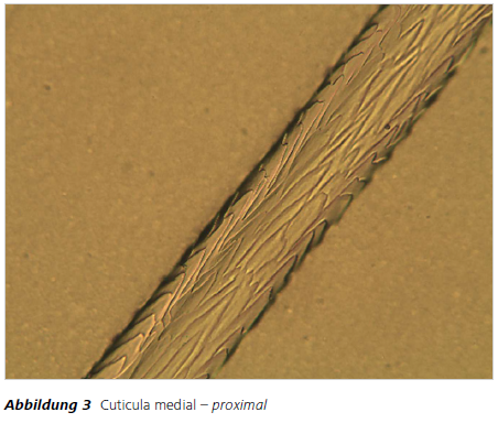 Abbildung 3 Cuticula medial – proximal